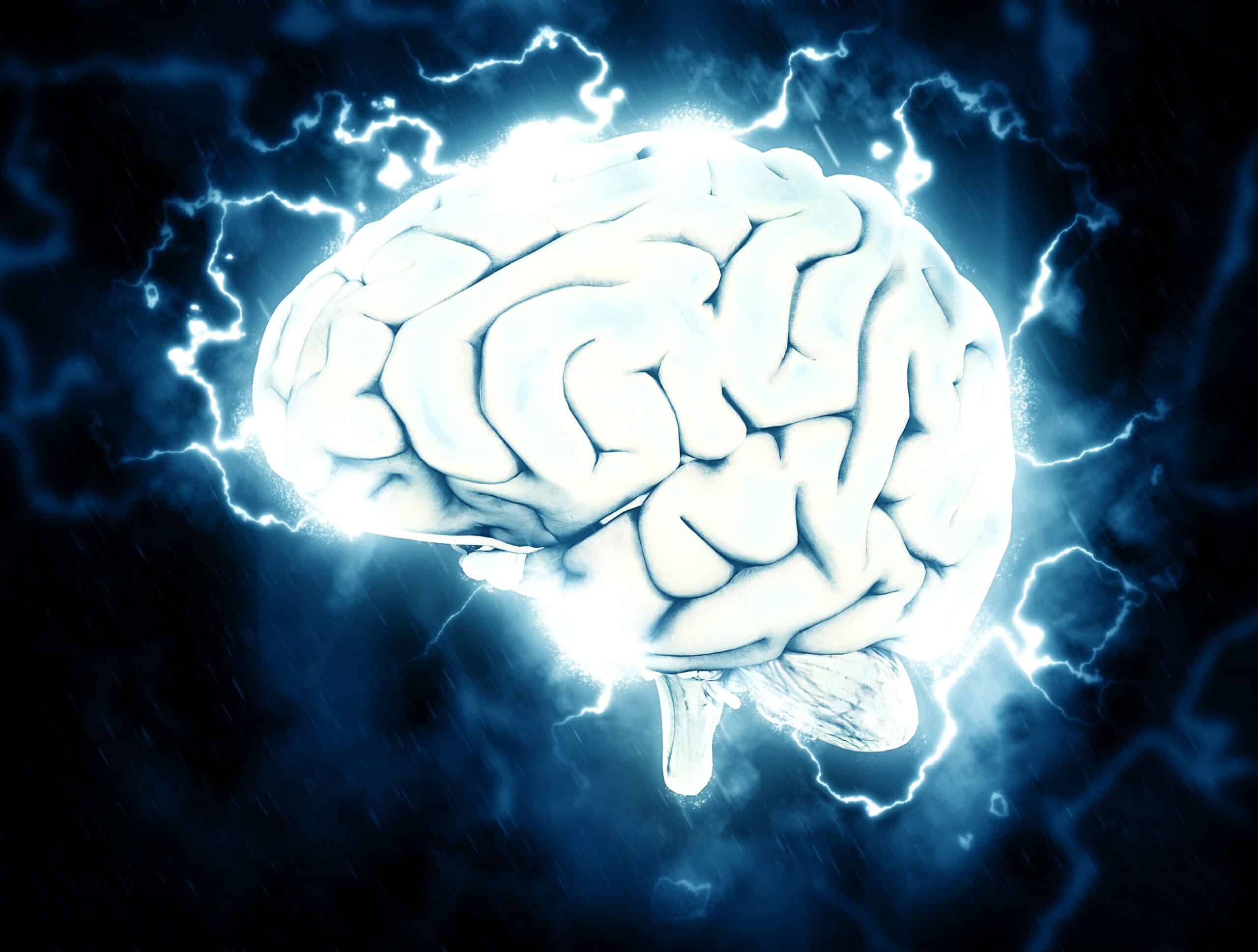 Brain 1845962 Scaled